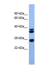 FGF3 antibody western blot of Rat Liver lysate.