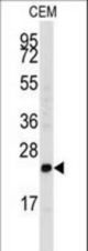 Western blot of anti-FGF4 Antibody in CEM cell line lysates (35 ug/lane). FGF4 (arrow) was detected using the purified antibody.