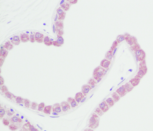 IHC of FGF7 / KGF antibody LS-C104693