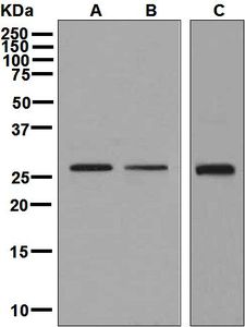 Western blot analysis on (A) fetal brain, (B) 293T, and (C) fetal kidney lysates using anti-FGF7 antibody.