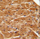 FGF7 antibody immunohistochemistry of formalin-fixed and paraffin-embedded human M.heart tissue followed by peroxidase-conjugated secondary antibody and DAB staining.