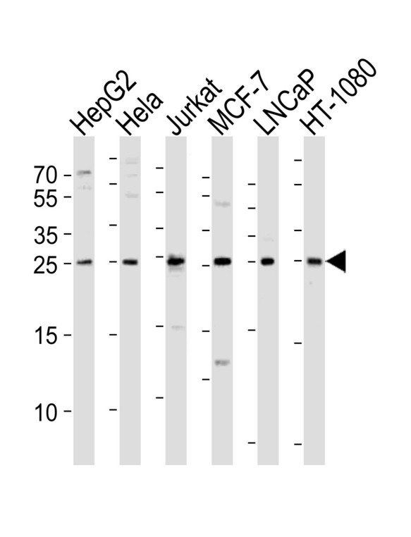 Western blot of lysates from HepG2, HeLa, Jurkat, MCF-7, LNCaP, HT-1080 cell line (from left to right) with FGF8 Antibody. Antibody was diluted at 1:1000 at each lane. A goat anti-rabbit IgG H&L (HRP) at 1:10000 dilution was used as the secondary antibody. Lysates at 20 ug per lane.