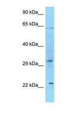 FGF8 antibody LS-C146310 Western blot of HeLa Cell lysate. Antibody concentration 1 ug/ml.