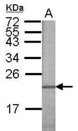 Anti-FGF8 antibody [N1C3] used in Western blot.
