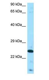 FGF8 antibody Western Blot of PANC1.