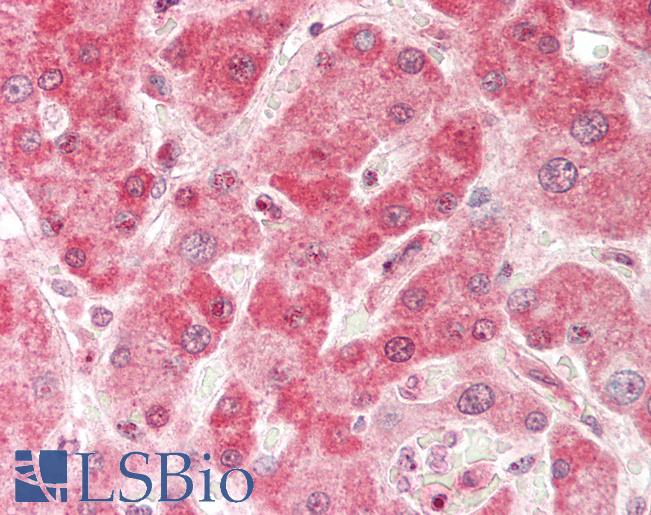 Human Liver: Formalin-Fixed, Paraffin-Embedded (FFPE)