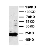 WB of FGF9 antibody. WB: Rat Brain Tissue Lysate.