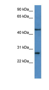 FGFBP2 antibody LS-C135832 Western blot of HeLa lysate.