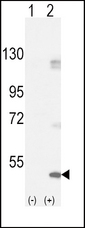 Western blot of FGFR1 (arrow) using rabbit polyclonal FGFR1-pY154. 293 cell lysates (2 ug/lane) either nontransfected (Lane 1) or transiently transfected with the FGFR1 gene (Lane 2).