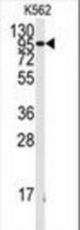 Western blot of anti-FGFR1 Antibody (Y154) in K562 cell line lysates (35 ug/lane). FGFR1 (arrow) was detected using the purified antibody.