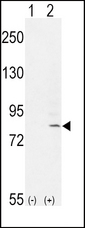 Western blot of FGFR1 (arrow) using rabbit polyclonal FGFR1-Y307. 293 cell lysates (2 ug/lane) either nontransfected (Lane 1) or transiently transfected with the FGFR1 gene (Lane 2).