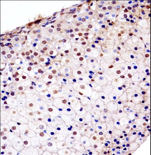 Mouse Fgfr1 Antibody immunohistochemistry of formalin-fixed and paraffin-embedded mouse adrenal glands followed by peroxidase-conjugated secondary antibody and DAB staining.