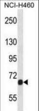 Mouse Fgfr1 Antibody western blot of NCI-H460 cell line lysates (35 ug/lane). The Fgfr1 antibody detected the Fgfr1 protein (arrow).