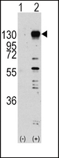 Western blot of FGFR1 (arrow) using rabbit polyclonal FGFR1 Antibody (Y653) (RB11303). 293 cell lysates (2 ug/lane) either nontransfected (Lane 1) or transiently transfected with the FGFR1 gene (Lane 2) (Origene Technologies).