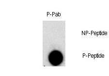 Dot blot of Phospho-FGFR1-Y307 polyclonal antibody on nitrocellulose membrane. 50ng of Phospho-peptide or Non Phospho-peptide per dot were adsorbed. Antibody working concentration was 0.5ug per ml. P-antibody: phospho-antibody; P-Peptide: phospho-peptide; NP-Peptide: non-phospho-peptide.