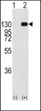 Western blot of FGFR1 (arrow) using rabbit polyclonal FGFR1 Antibody (Y463) (RB11175). 293 cell lysates (2 ug/lane) either nontransfected (Lane 1) or transiently transfected with the FGFR1 gene (Lane 2) (Origene Technologies).