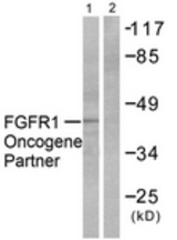 Western blot of extracts from HepG2 cells, using FGFR1 Oncogene Partner Antibody. The lane on the right is treated with the synthesized peptide.