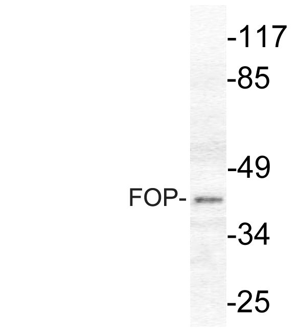 Western blot of FGFR1OP (N371) pAb in extracts from HepG2 cells.