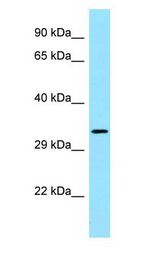 FGFR1OP2 antibody Western Blot of MCF7.