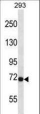 Mouse Fgfr3 Antibody western blot of 293 cell line lysates (35 ug/lane). The Fgfr3 antibody detected the Fgfr3 protein (arrow).