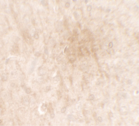 Immunohistochemistry of FGFR3 in rat brain tissue with FGFR3 antibody at 2.5 ug/ml.