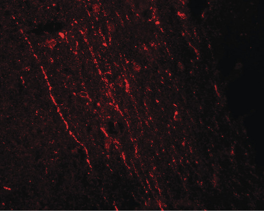 Immunofluorescence of FGFR3 in rat brain tissue with FGFR3 antibody at 20 ug/ml.