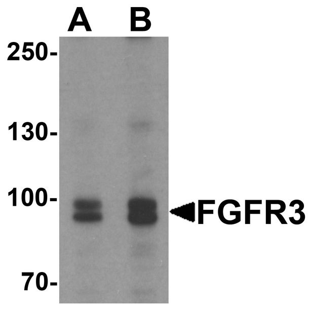 Western blot analysis of FGFR3 in SK-N-SH cell lysate with FGFR3 antibody at (A) 0.5 and (B) 1 ug/ml.
