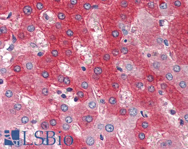 Anti-FGFR4 antibody IHC of human liver. Immunohistochemistry of formalin-fixed, paraffin-embedded tissue after heat-induced antigen retrieval. Antibody LS-B3447 dilution 1:200.