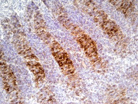 FGF R4 in Mouse Embryo. FGF R4 was detected in immersion fixed frozen sections of mouse embryo (11.5 d. p. c.) using Goat Anti-Mouse FGF R4 Antigen Affinity-purified Polyclonal Antibody at 5 ug/ml overnight at 4 °C. Tissue was stained using Anti-Goat HRP-DAB (brown) and counterstained with hematoxylin (blue). Specific staining was localized to cartilage.