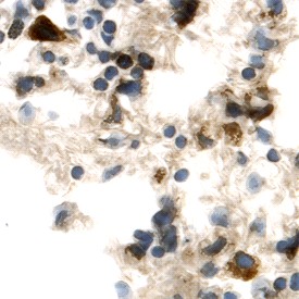 FGF R5/FGFRL1 in Mouse Lung. FGF R5/FGFRL1 was detected in perfusion fixed frozen sections of mouse lung using Goat Anti-Mouse FGF R5/FGFRL1 Antigen Affinity-purified Polyclonal Antibody at 15 ug/ml overnight at 4 °C. Tissue was stained using Anti-Goat HRP-DAB (brown) and counterstained with hematoxylin (blue). Specific labeling was localized to the plasma membrane and cytoplasm of alveolar cells.