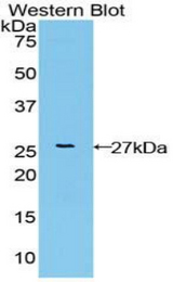 Western blot of recombinant FGFRL1.