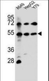 FGFRL1 Antibody western blot of A549,HepG2,Y79 cell line lysates (35 ug/lane). The FGFRL1 antibody detected the FGFRL1 protein (arrow).