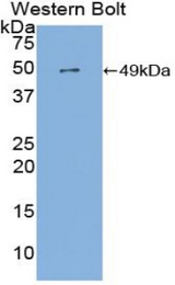 Western blot of recombinant FGG / Fibrinogen Gamma.