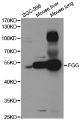 Western blot analysis of extracts of various cell lines, using FGG antibody.