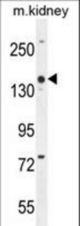 COBL Antibody western blot of mouse kidney tissue lysates (35 ug/lane). The COBL antibody detected the COBL protein (arrow).