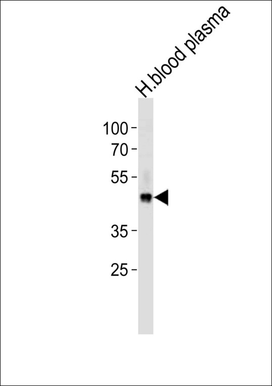 FGG Antibody western blot of human blood plasma cell line lysates (35 ug/lane). The FGG antibody detected the FGG protein (arrow).