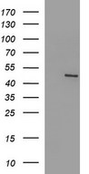 HEK293T cells were transfected with the pCMV6-ENTRY control (Left lane) or pCMV6-ENTRY FGG (Right lane) cDNA for 48 hrs and lysed. Equivalent amounts of cell lysates (5 ug per lane) were separated by SDS-PAGE and immunoblotted with anti-FGG.