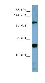 COBLL1 antibody LS-C107676 Western blot of Fetal Stomach lysate.