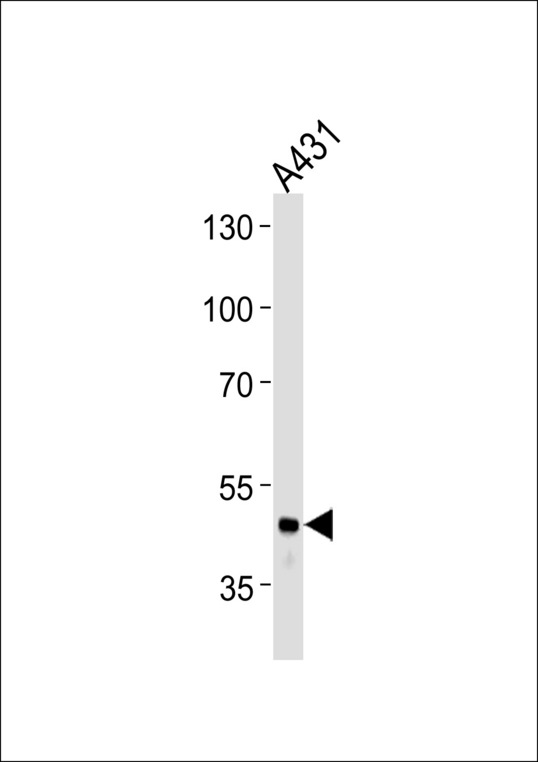 FGG Antibody western blot of A431 cell line lysates (35 ug/lane). The FGG antibody detected the FGG protein (arrow).