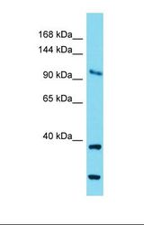 Western blot of Mouse Brain. Cog1 antibody dilution 1.0 ug/ml.