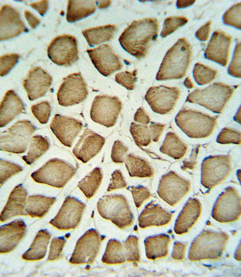 FIBG Antibody IHC of formalin-fixed and paraffin-embedded human skeletal muscle tissue followed by peroxidase-conjugated secondary antibody and DAB staining.