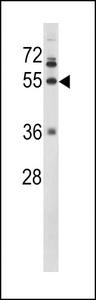 Western blot of FIBG Antibody in NCI-H460 cell line lysates (35 ug/lane). FIBG (arrow) was detected using the purified antibody.