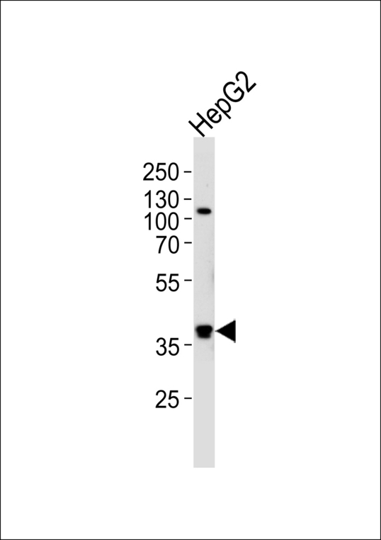 Western blot of lysate from HepG2 cell line, using FGL1 Antibody. Antibody was diluted at 1:1000 at each lane. A goat anti-rabbit IgG H&L (HRP) at 1:5000 dilution was used as the secondary antibody. Lysate at 35ug per lane.