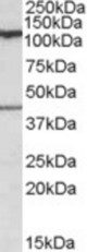 COG1 antibody (0.1 ug/ml) staining of Human Cerebellum lysate (35 ug protein/ml in RIPA buffer). Primary incubation was 1 hour. Detected by chemiluminescence.