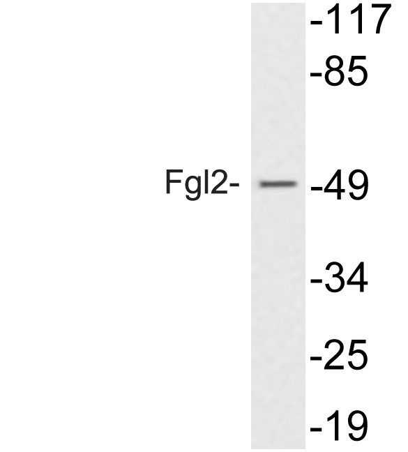Western blot of Fgl2 (V38) pAb in extracts from 293 cells treated with insulin.