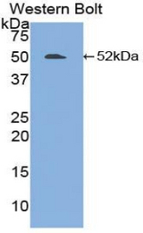 Western blot of recombinant FGL2.