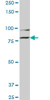 COG2 monoclonal antibody (M01), clone 3H8. Western blot of COG2 expression in IMR-32.