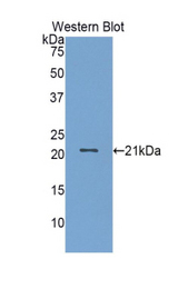 Western blot of recombinant FGL2.