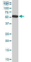 FGL2 monoclonal antibody (M01), clone 6D9. Western blot of FGL2 expression in Raw 264.7.