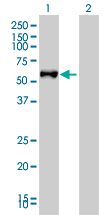 Western blot of FGL2 expression in transfected 293T cell line by FGL2 monoclonal antibody (M01), clone 6D9.